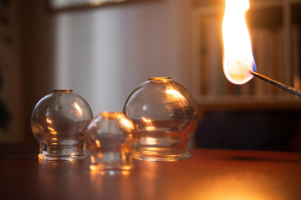 Fire cupping glass jars being prepared